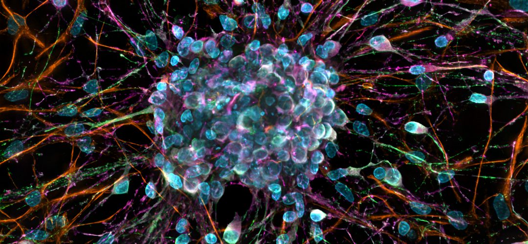 Phase 2 for long acting HIV therapy set to begin