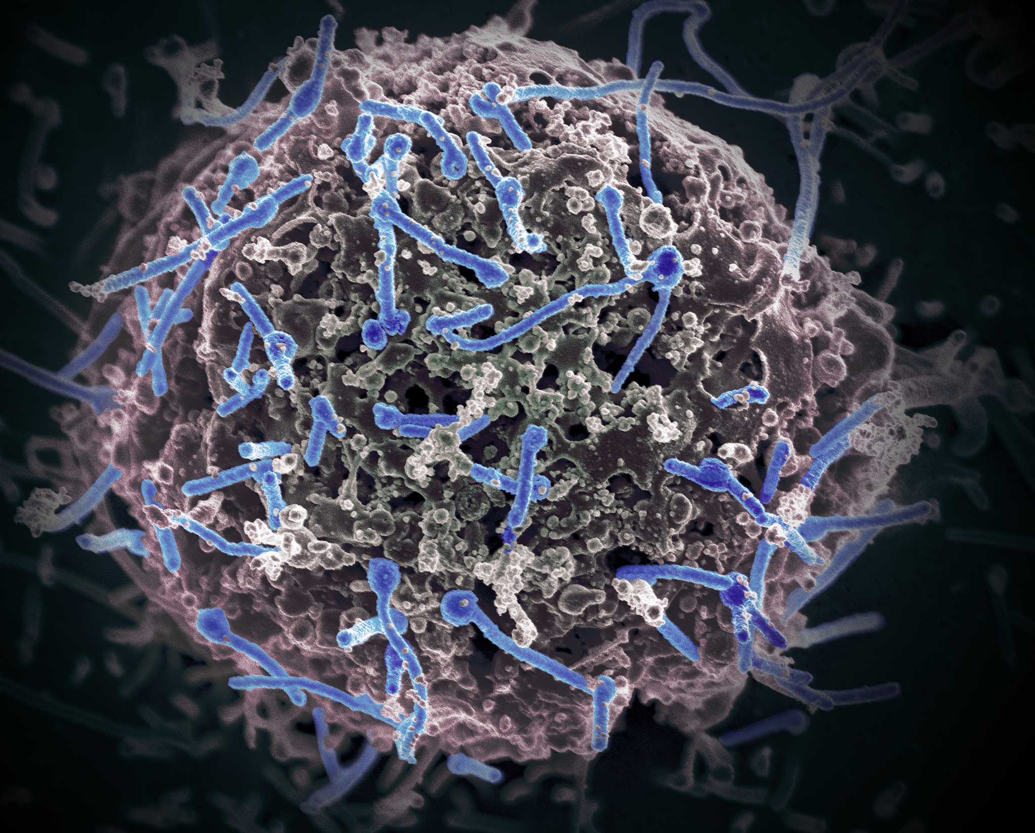 Researchers closer to understanding how antibodies bind to the Ebola virus