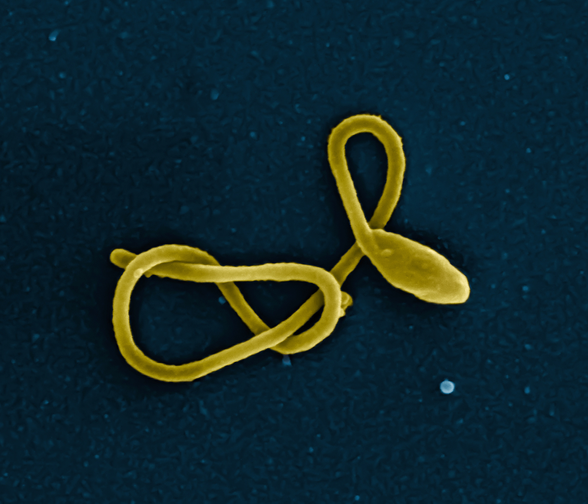Discovery of Ebola-neutralizing antibodies makes a universal vaccine possible