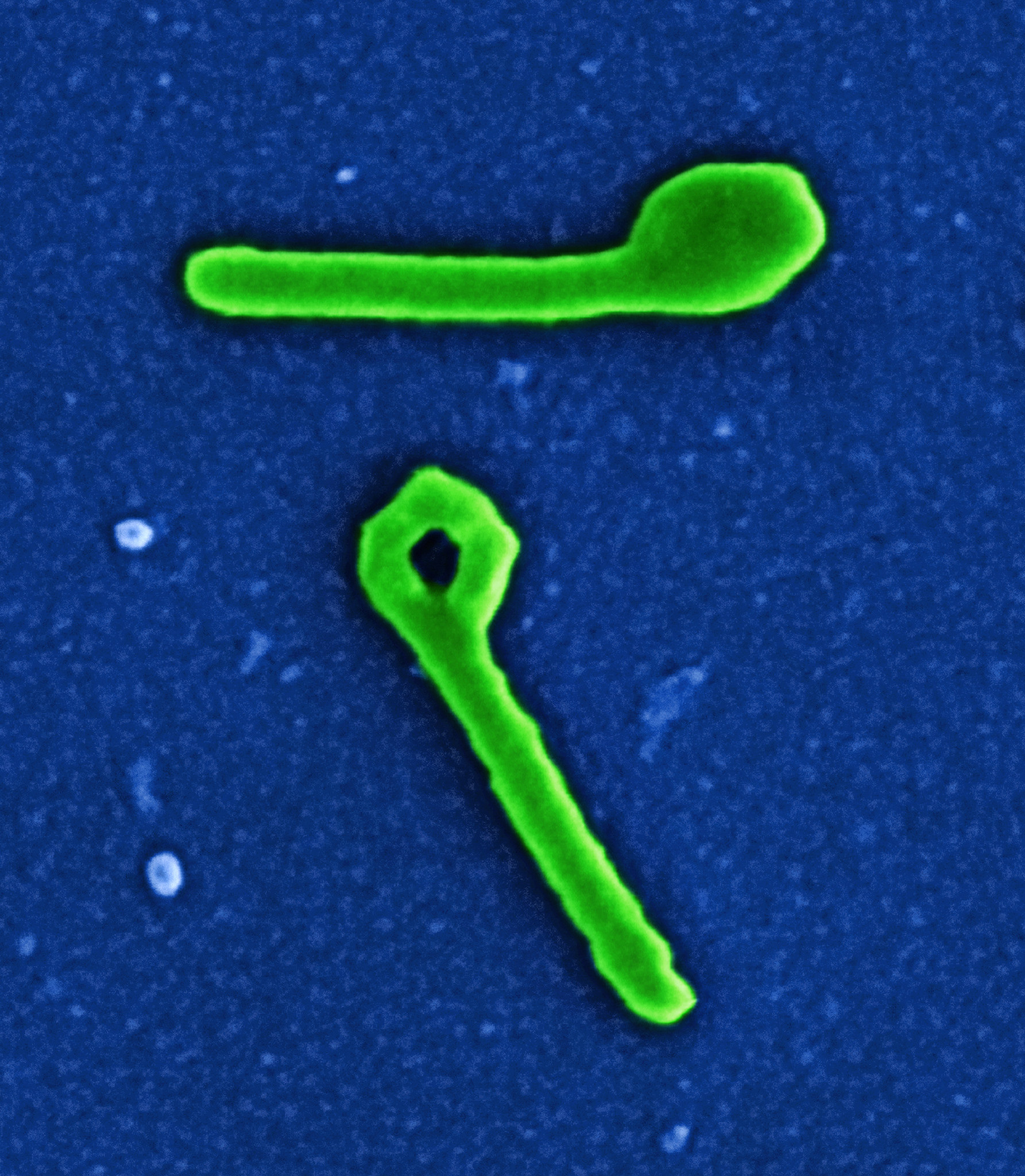 DAILY DOSE: Rare Ebola Strain Sparks Regional Alarm; Multivitamins May Nudge Biological Aging in the Right Direction.