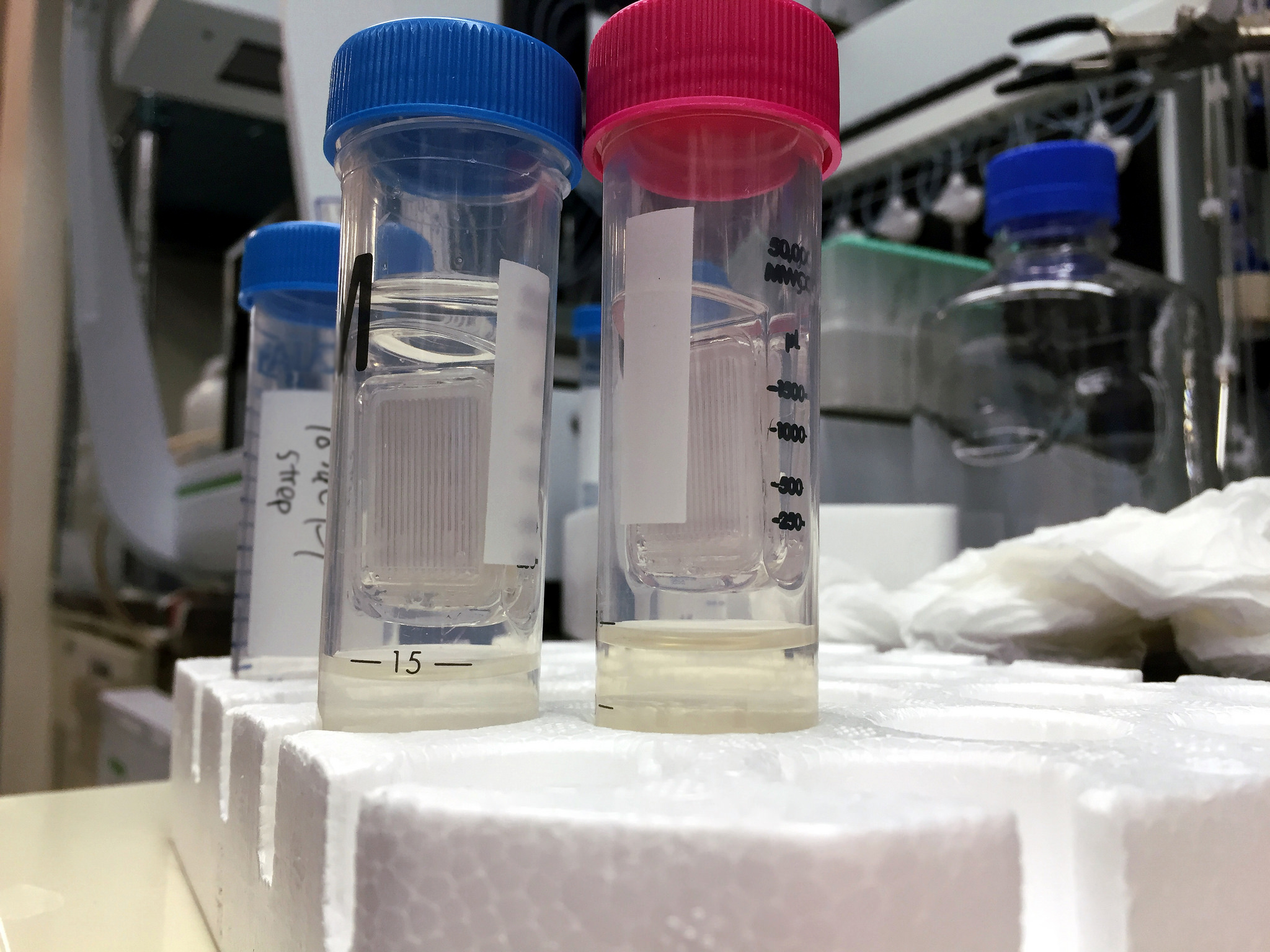 Researchers pinpoint protein key to RSV infection