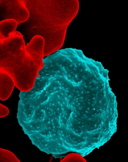 Methylation puts parasites in motion