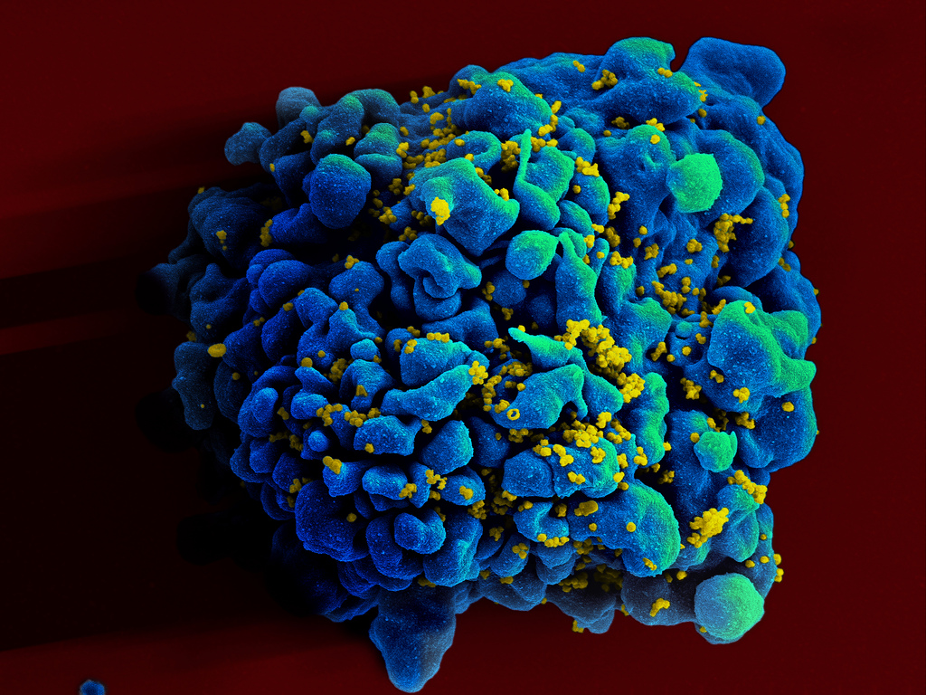 The cure for HIV may lie with a different virus