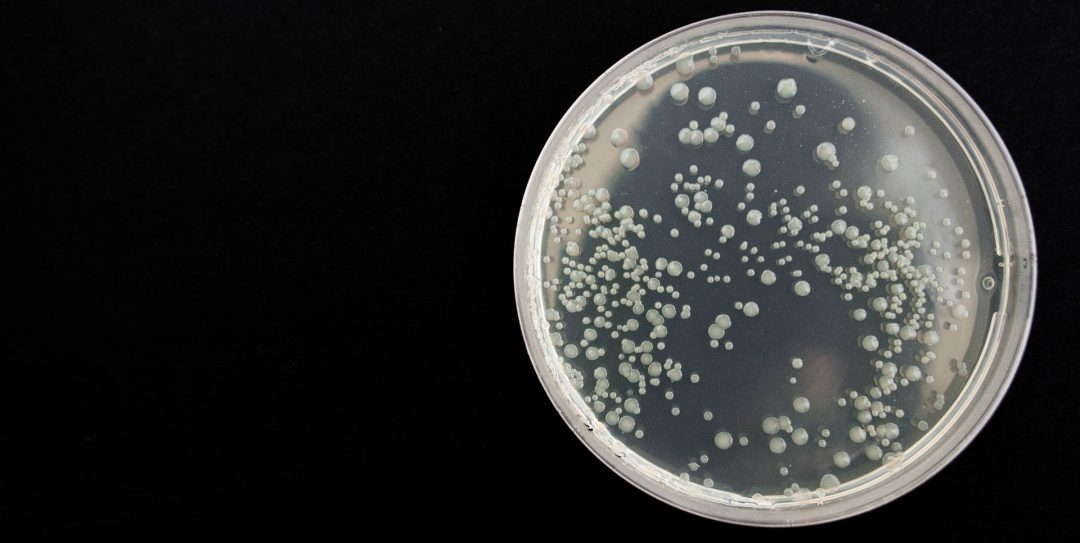 Types of bacteria vary widely in tumors of people with early vs. late-onset colorectal cancer