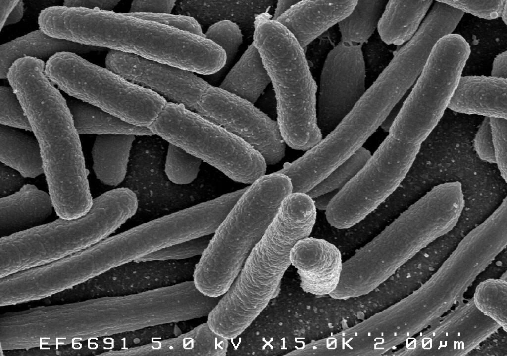 Scientists take a peek into an actual microbiome