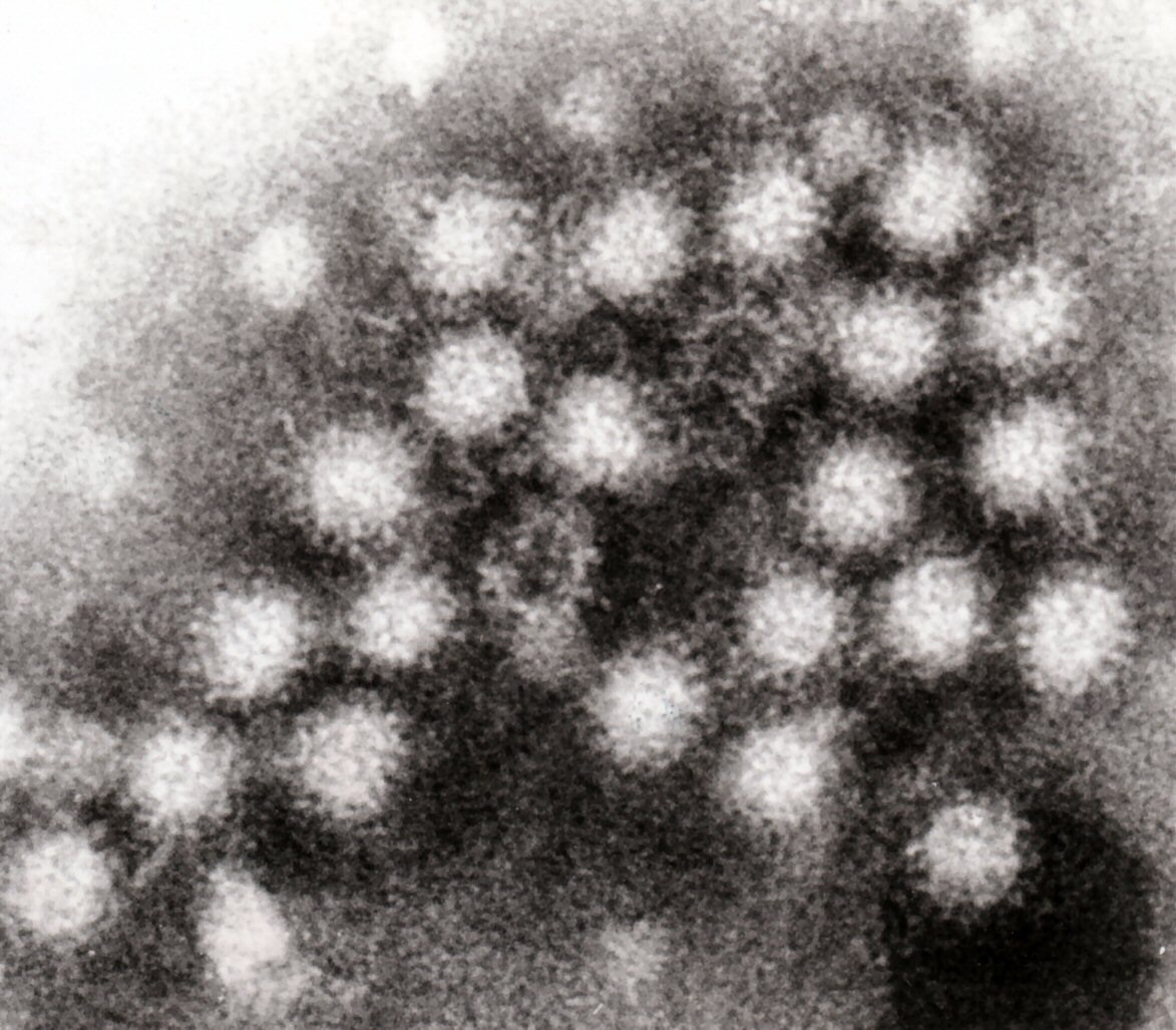 Noroviruses evade immune responses by hiding out in gut cells
