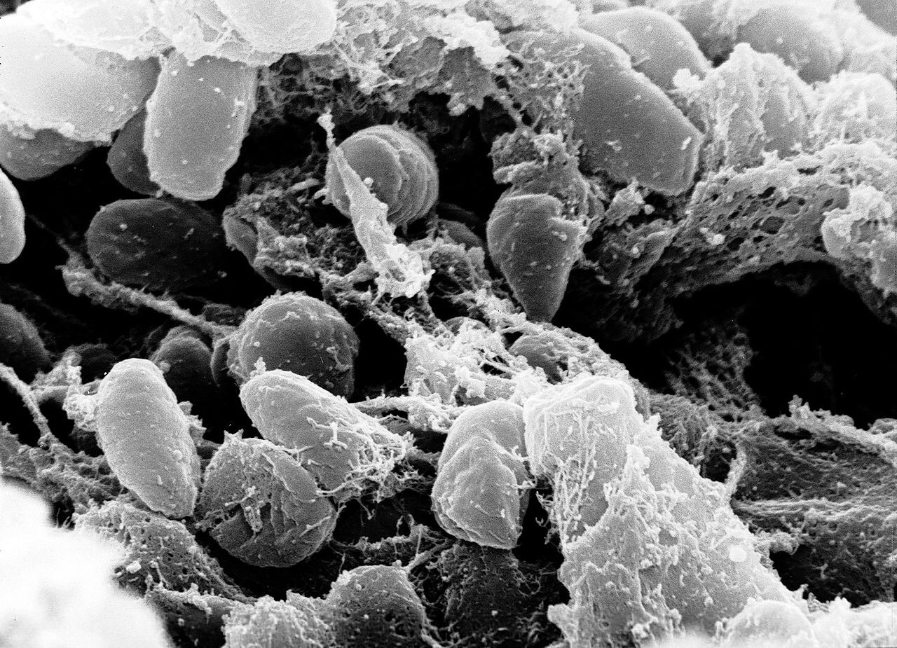 Study confirms ancient plague entered Europe via Eurasian steppe