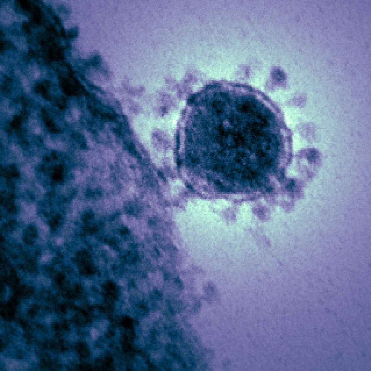 The virus that causes the common cold keeps changing