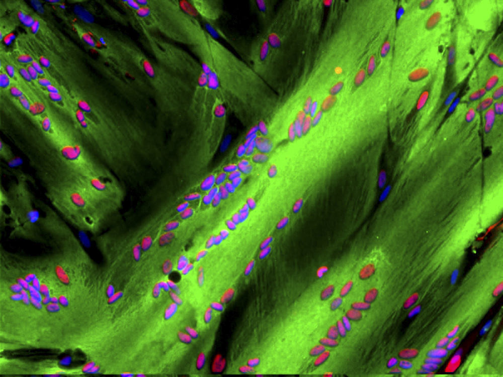 Scientists Find the Molecular Switch Behind Aging Muscle’s Biggest Paradox