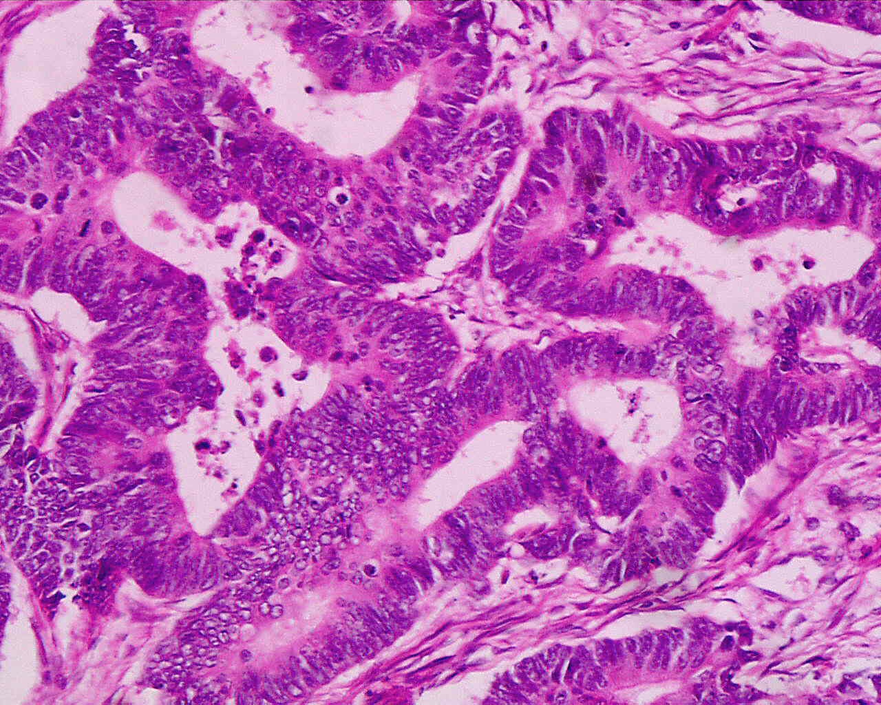 33 cancers analyzed at a molecular level in important study