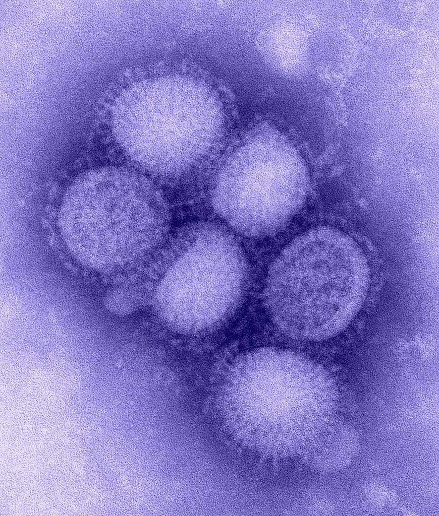 DAILY DOSE: Forget Covid-19, the origin of the influenza virus is crazy; An overcooked fish discovered in 5000-year old restaurant.