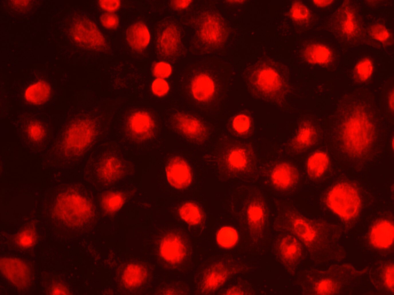 Microglia may offer some protection against prions