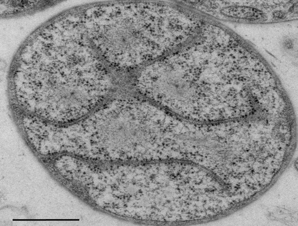 Schizophrenia patients appear to have more microbes in their bloodstream