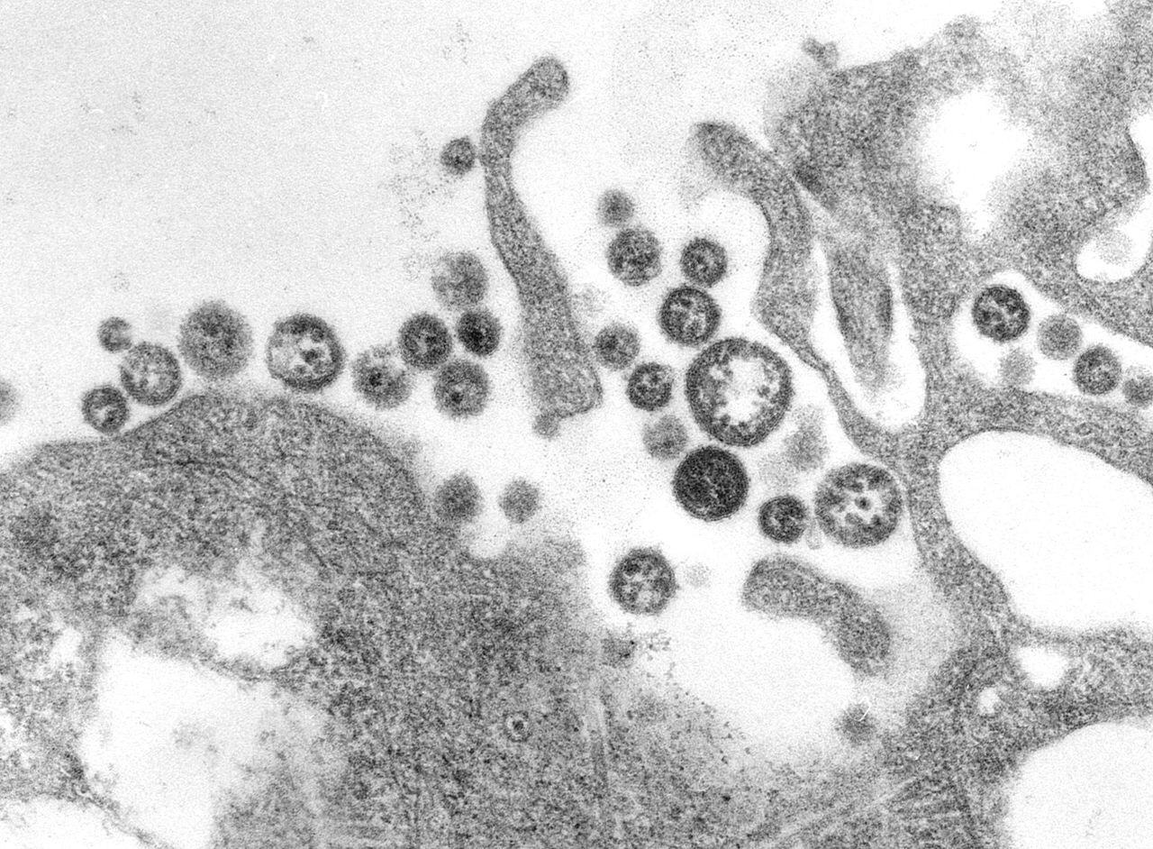 New vaccine candidate protects against Lassa fever and rabies