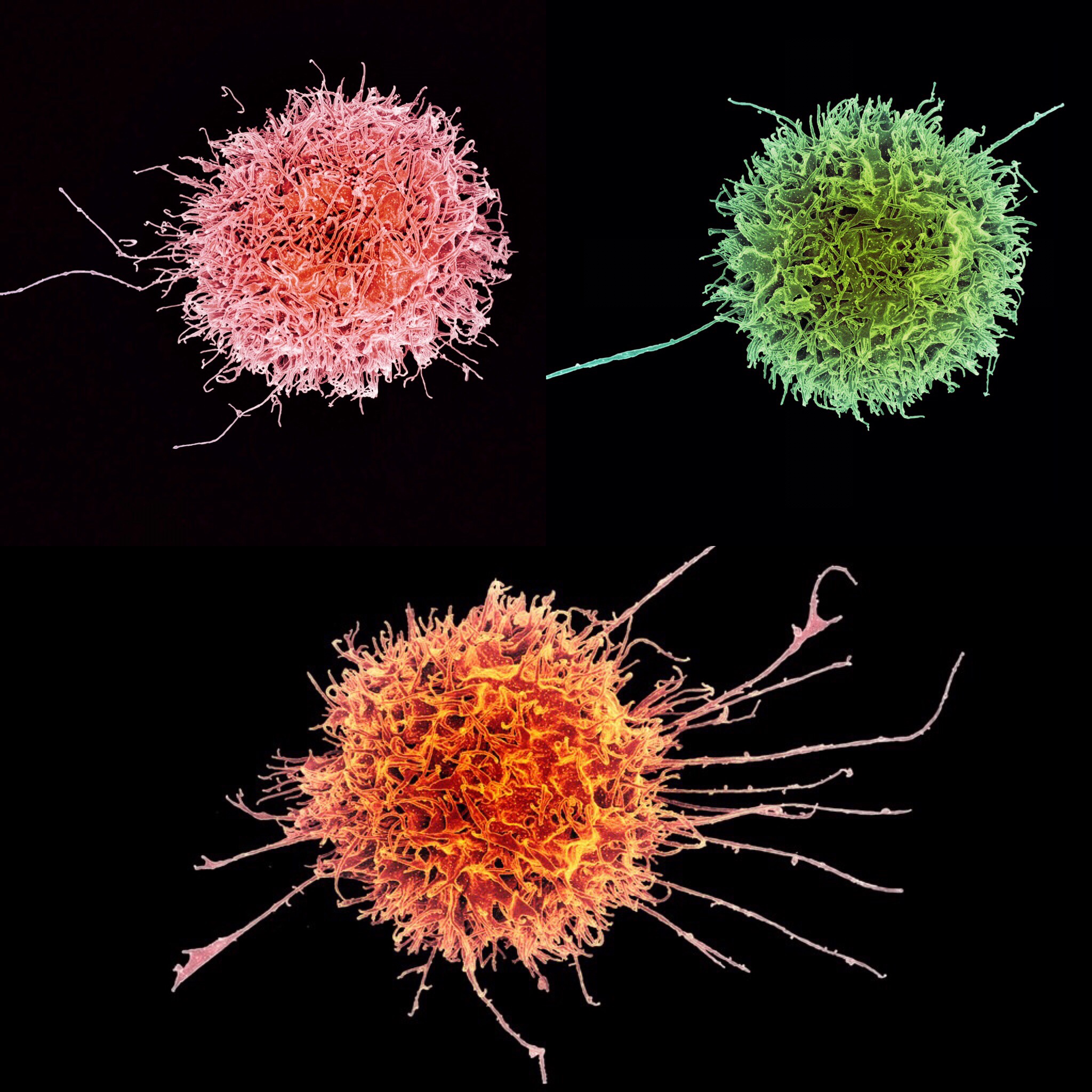 Images We Love: Florescent NK cells