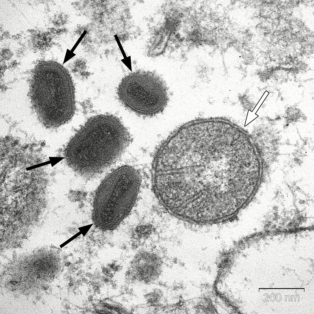 Vaccinia virus hijacks infected cells then goes for a ride