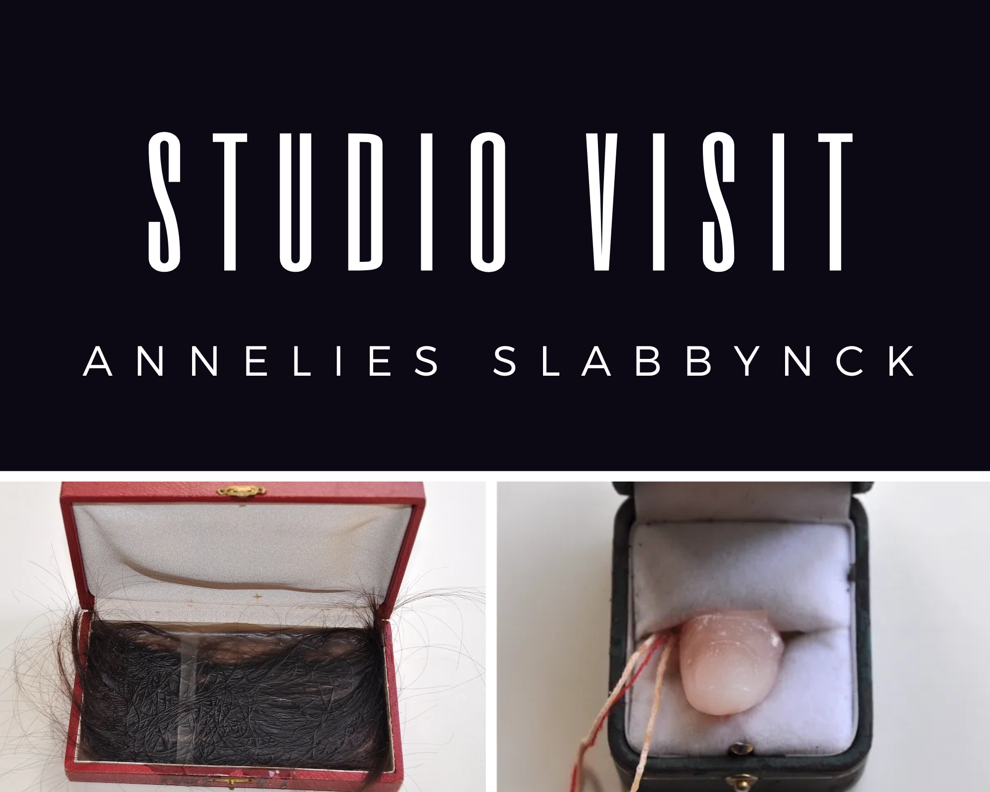 Annelies Slabbynck: Exploring the imperfect mutability of the female body