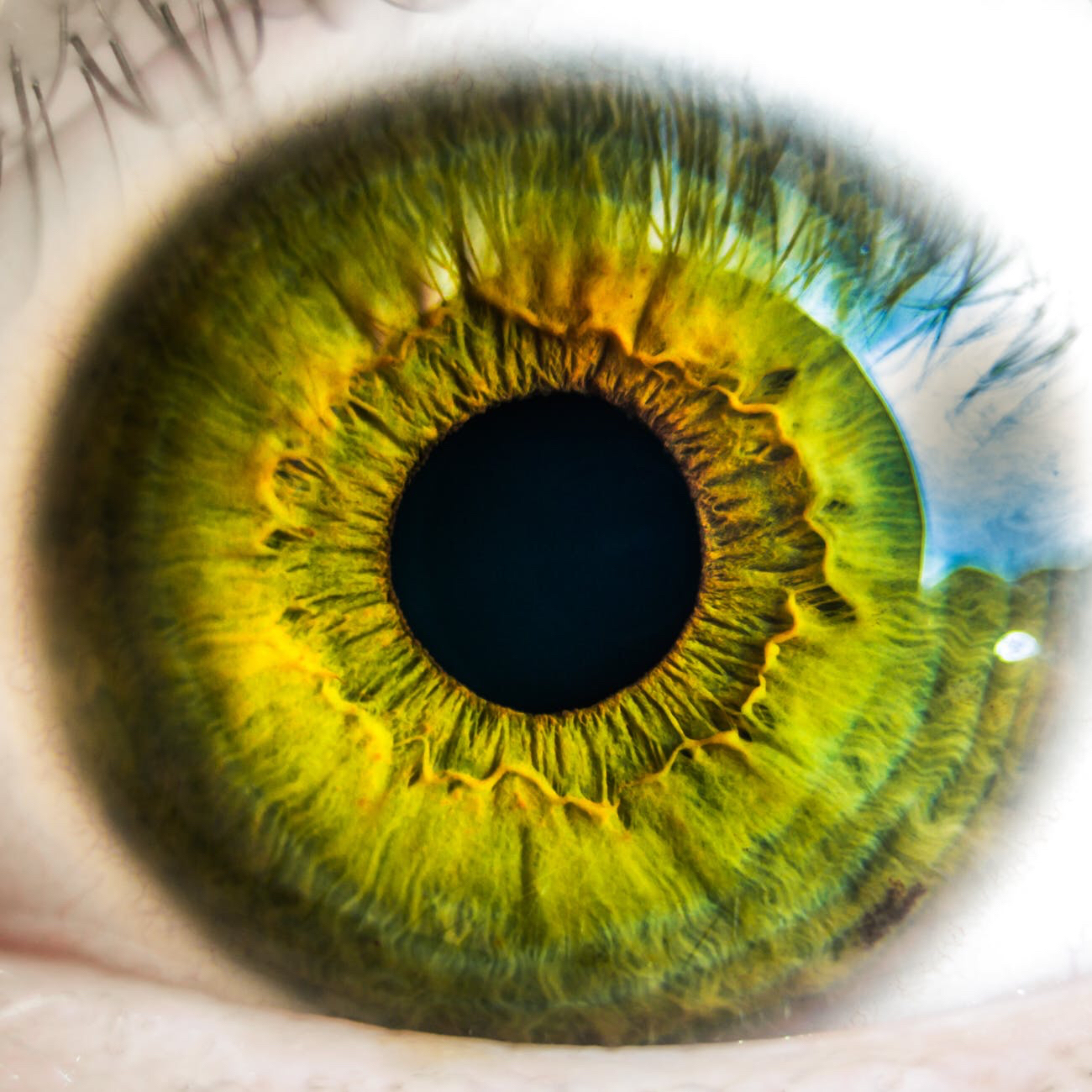 Taking a step toward understanding AMD