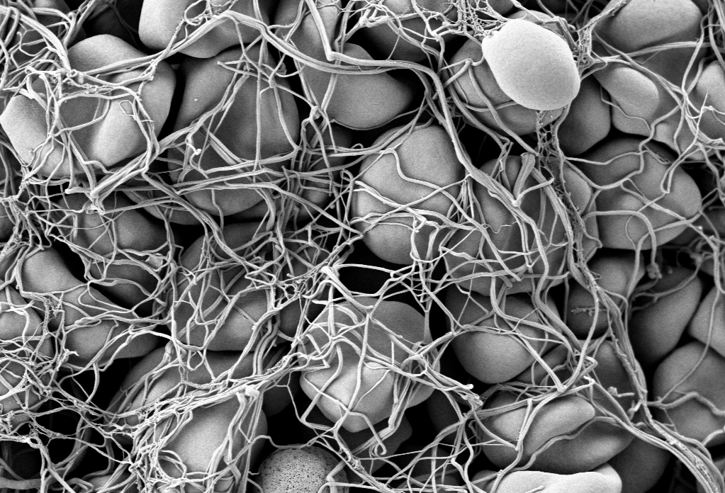 Mechanical aspect of blood clotting is clearer now