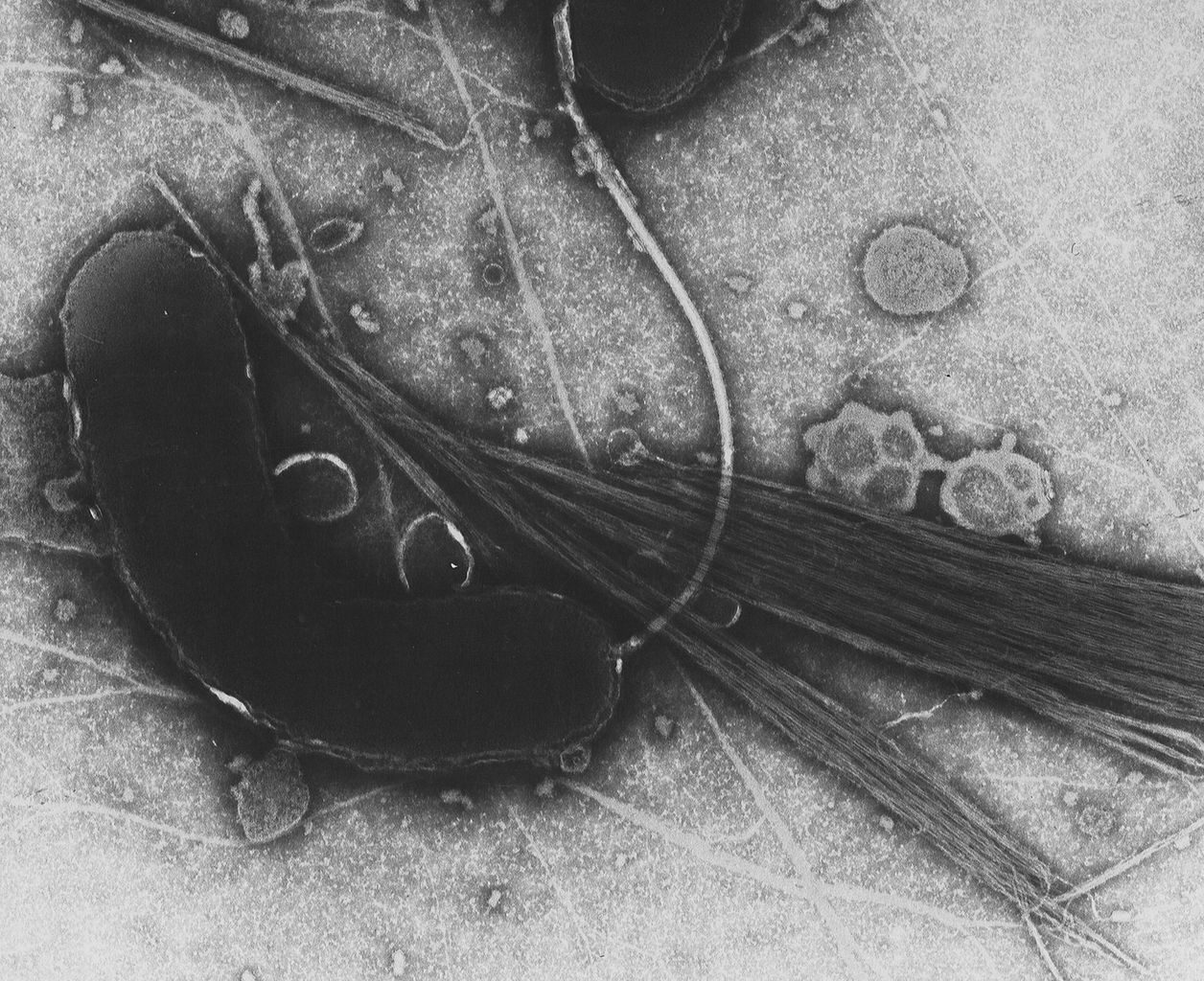 A hundred year old strain of cholera bacteria has been decoded