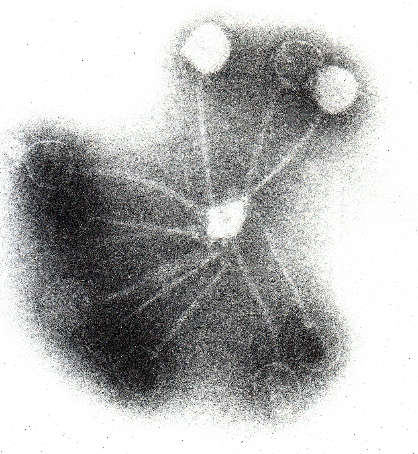 Bacteriophage therapy proves its worth again