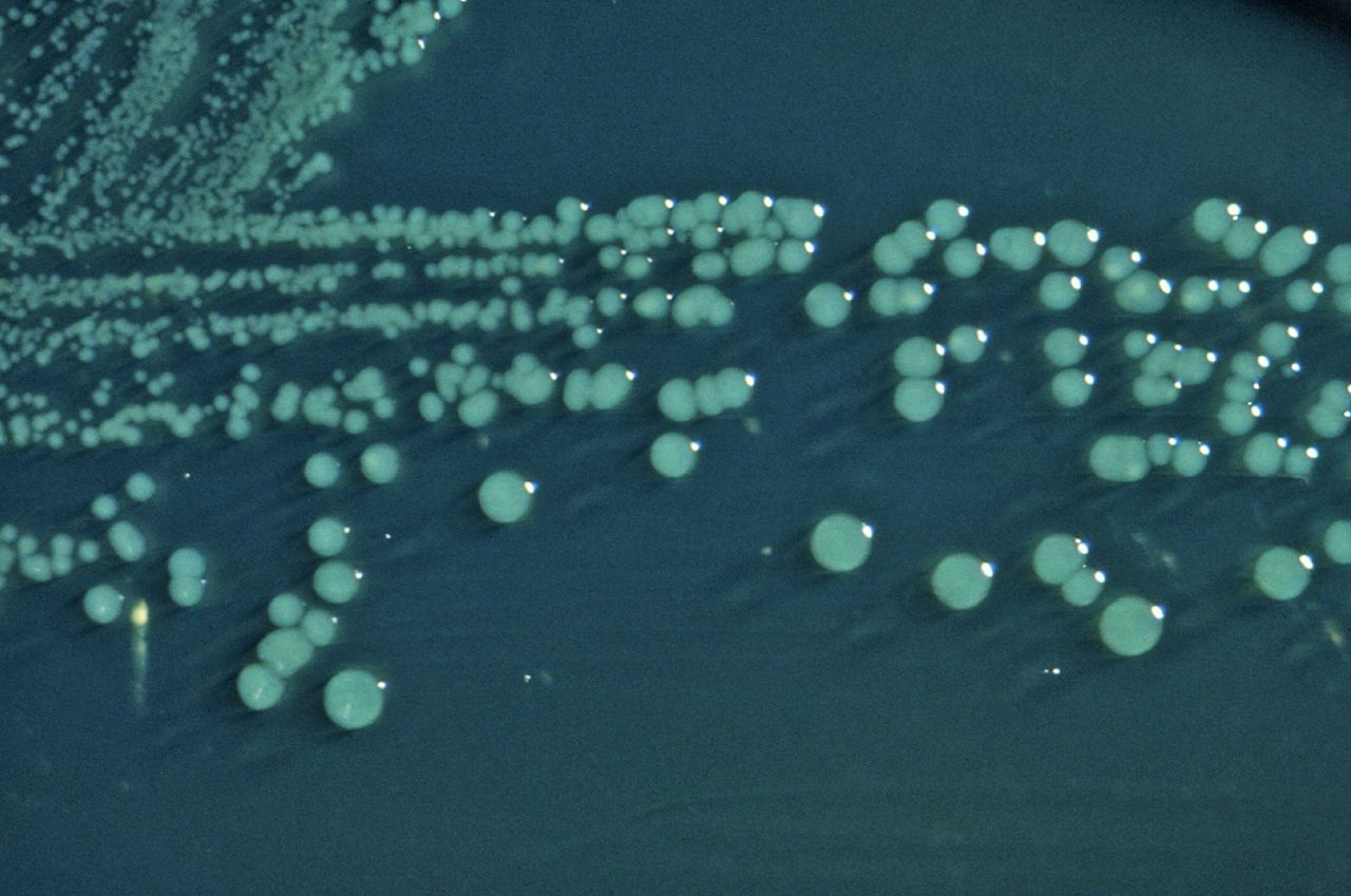 In order to survive, bacteria can shut off certain immune responses