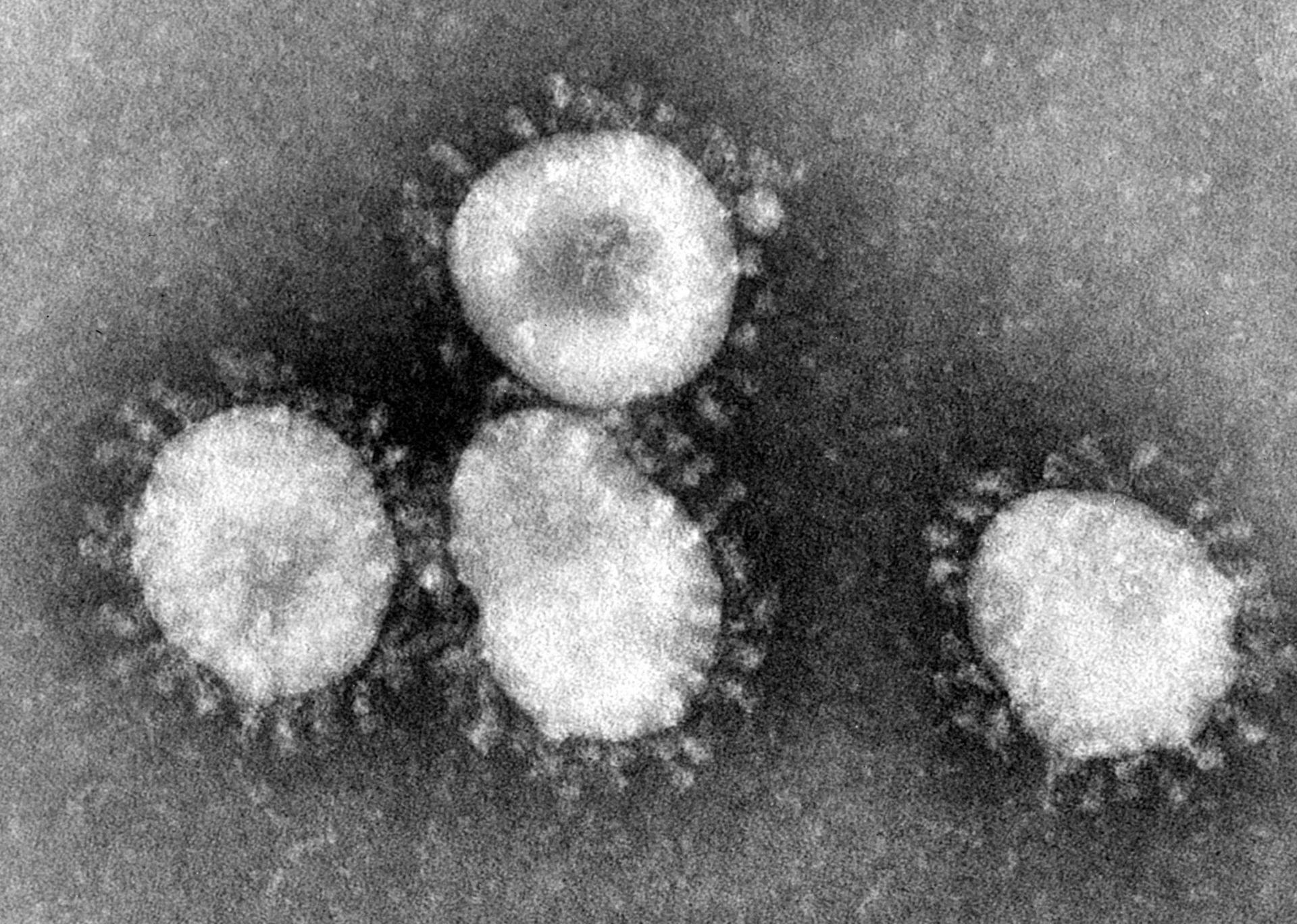 Novel coronavirus spreads around the globe; CDC confirms U.S. case
