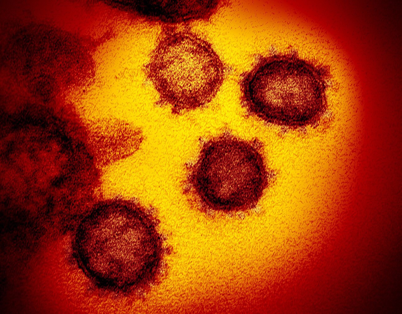 The Daily Dose: Can the coronavirus be constructed in a lab from scratch?