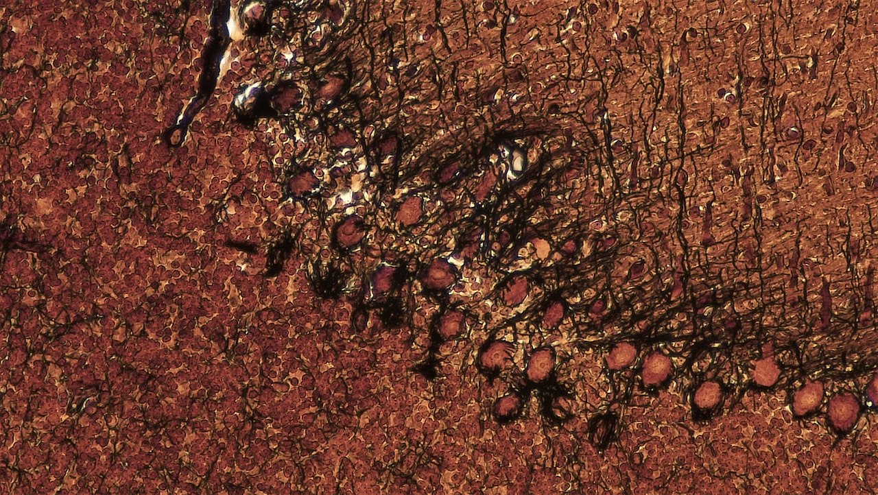 Researchers pinpoint Purkinje cells as source of tremors