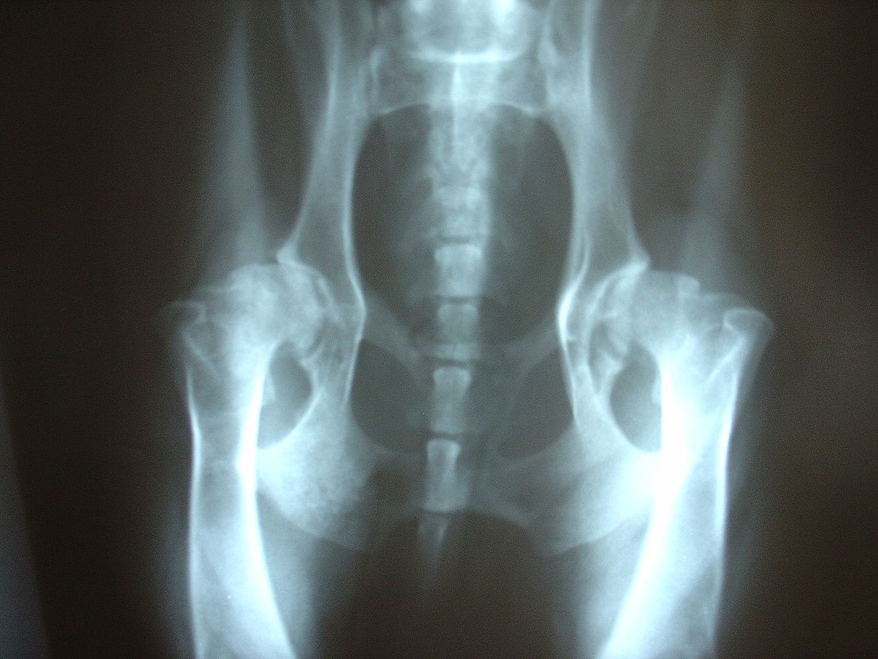 Osteoarthritis in Australia keeps rising