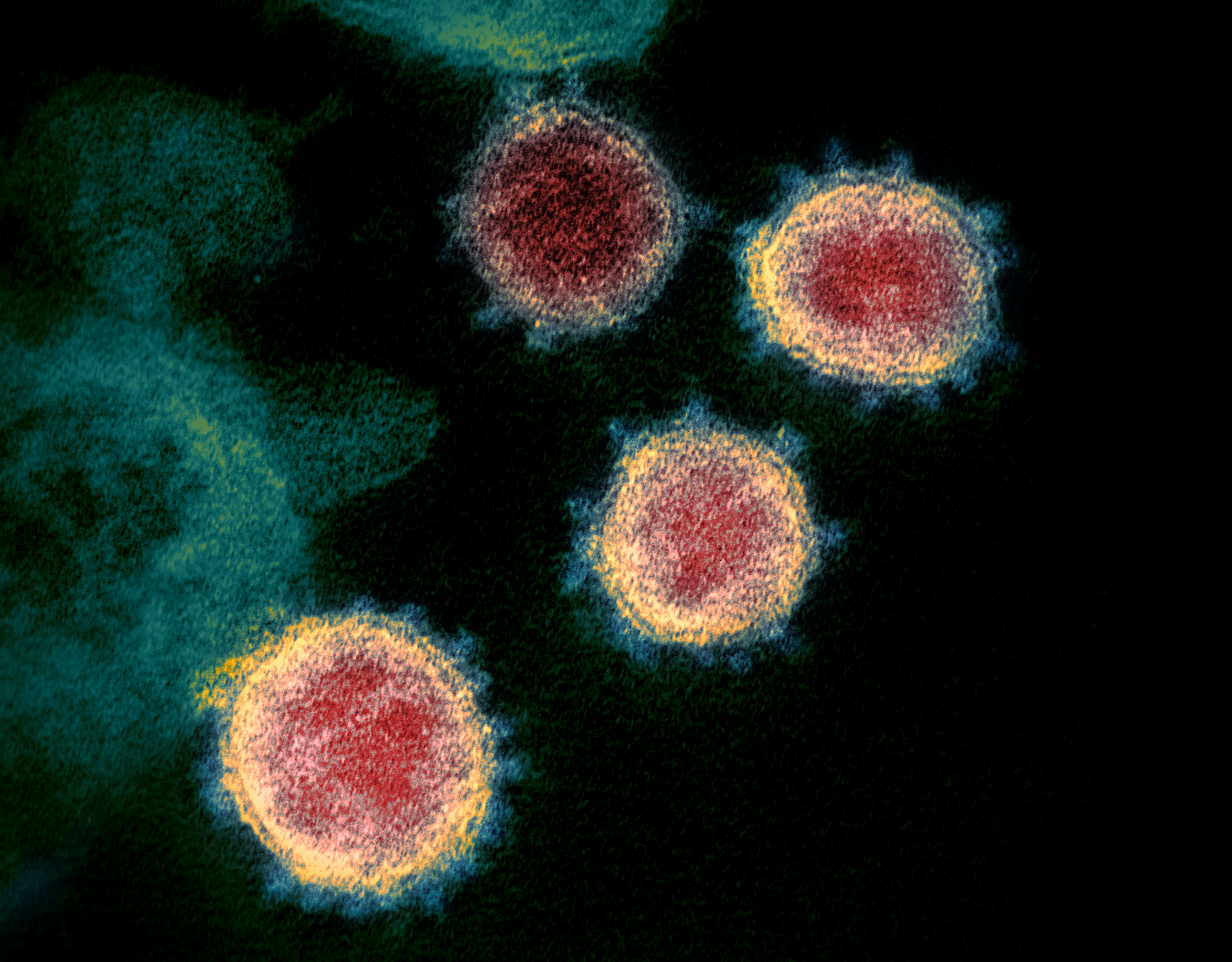 Portrait of the virus as a deadly pathogen