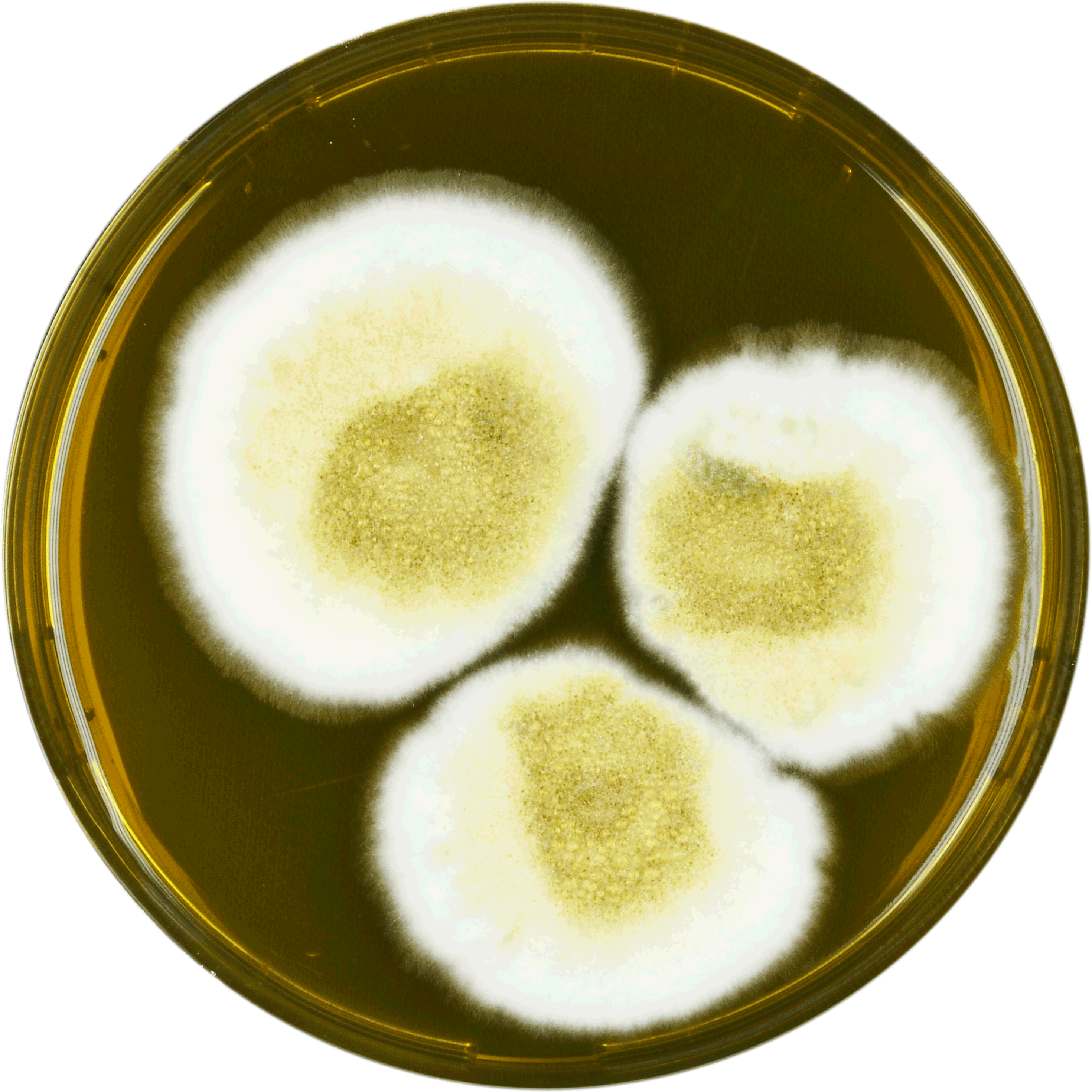 New form of fungus discovered in hospital lung infection