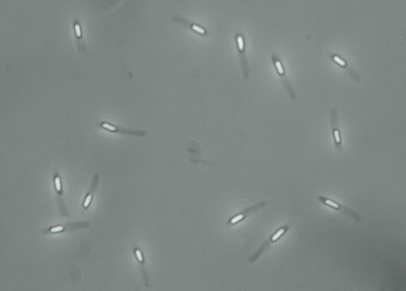 Bacteria discovered associated with deadly pediatric disease