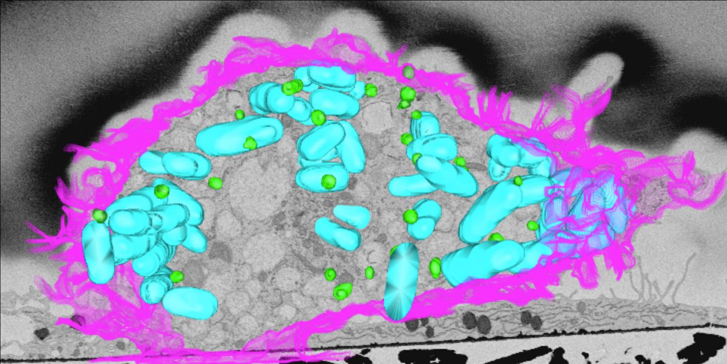 Even fat cells have bacteria in their crosshairs.
