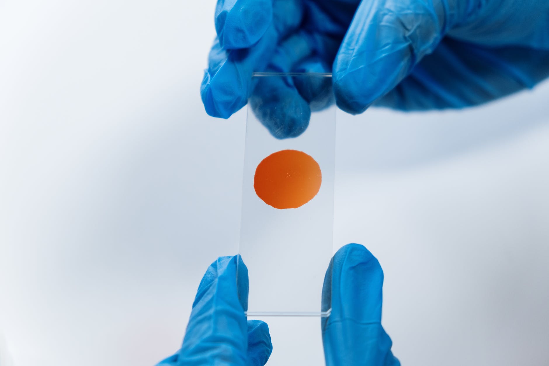 New technology can help determine Fibrinogen levels quickly.