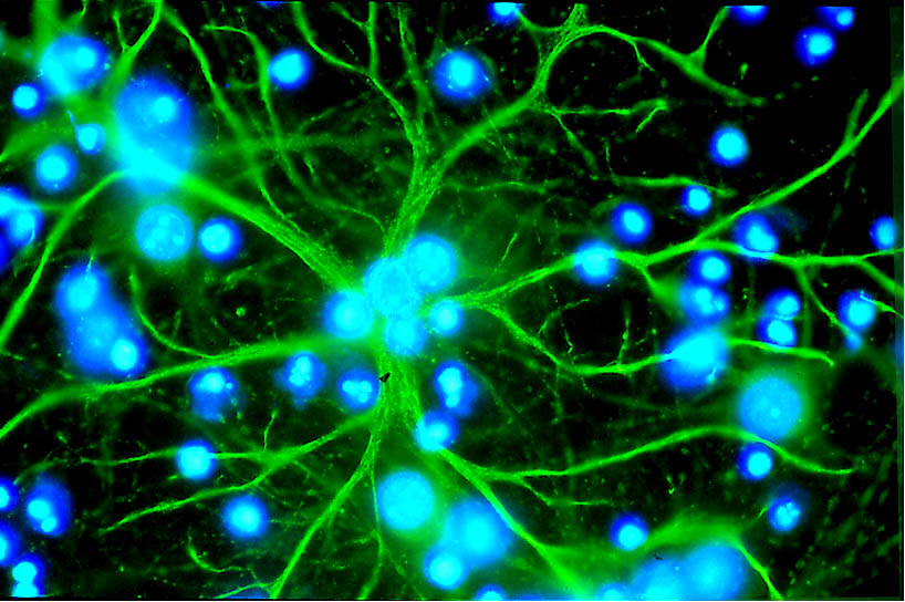 Astrocytes may play a role in MS seizures.