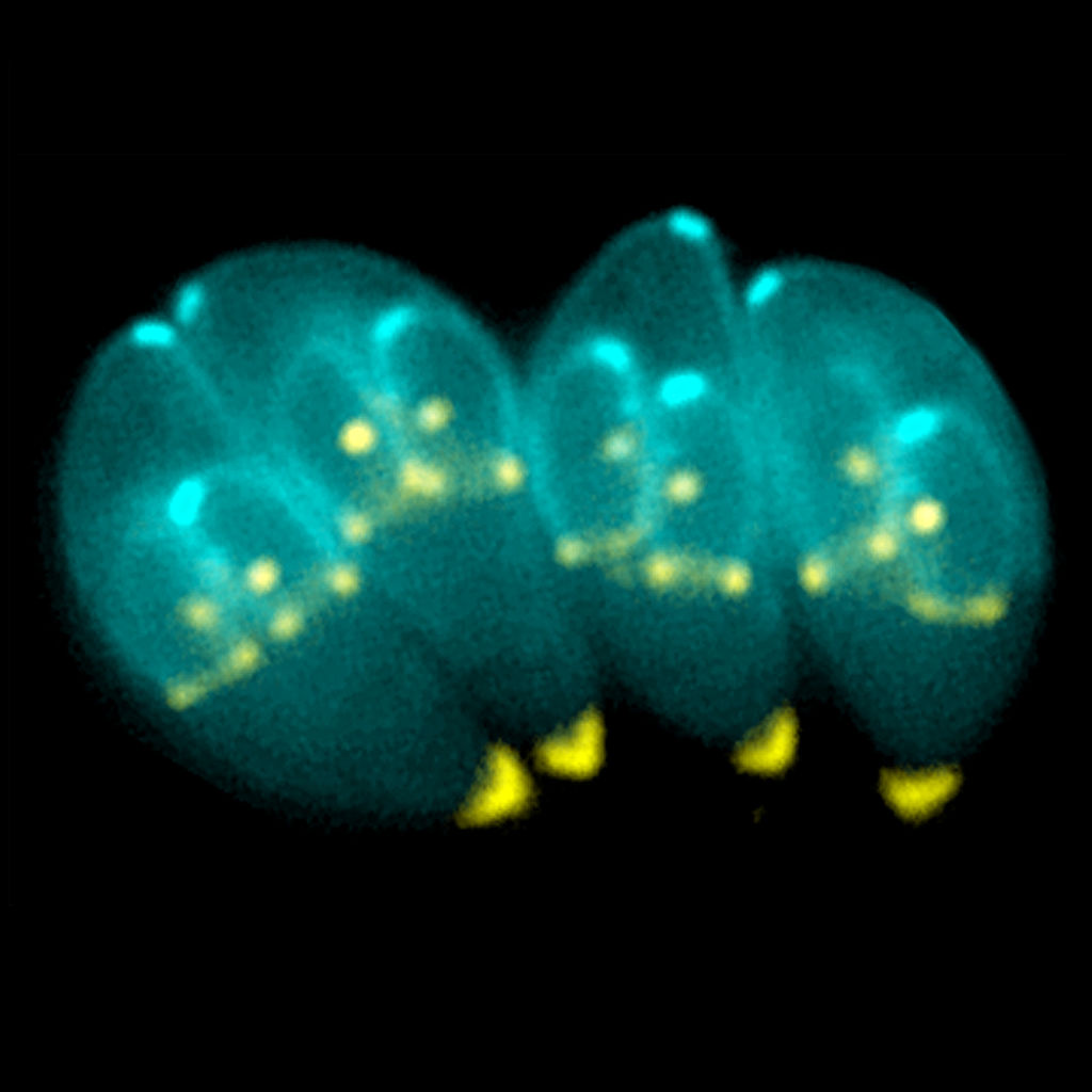 Common food-borne pathogen linked to brain cancer.