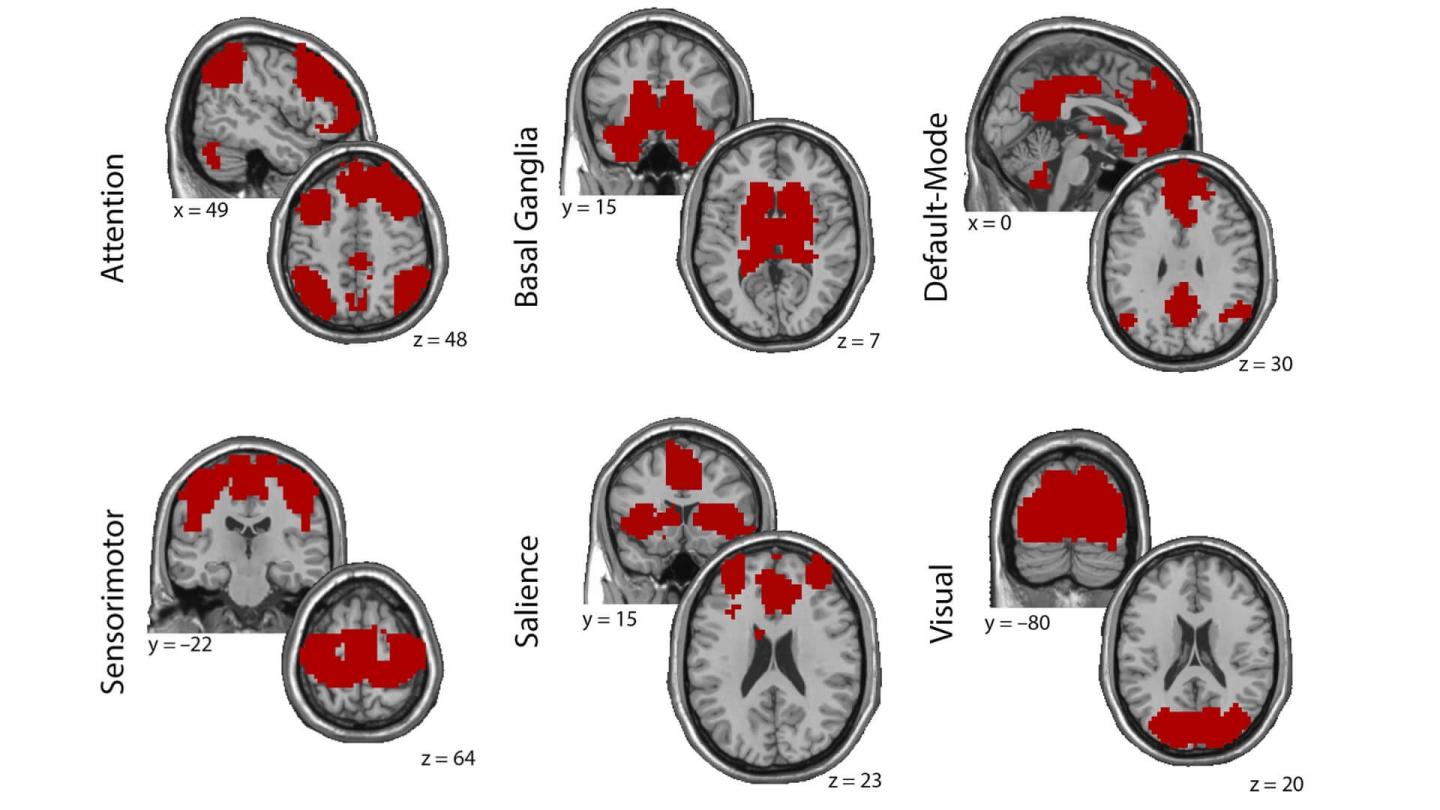 Tracking traumatic stress in the brain with new technology.