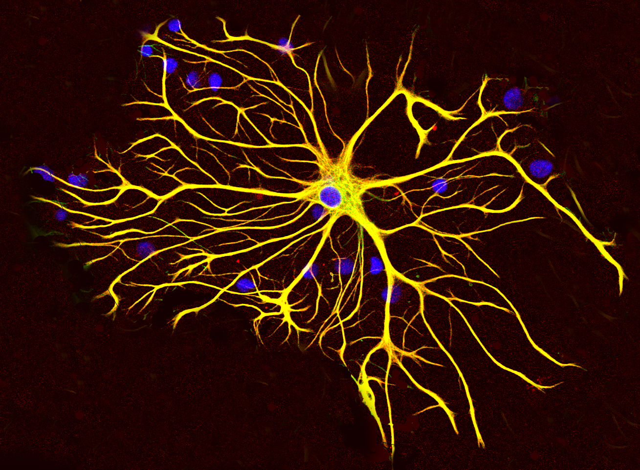 Astrocytes responsible for primary synapse decreases, study.