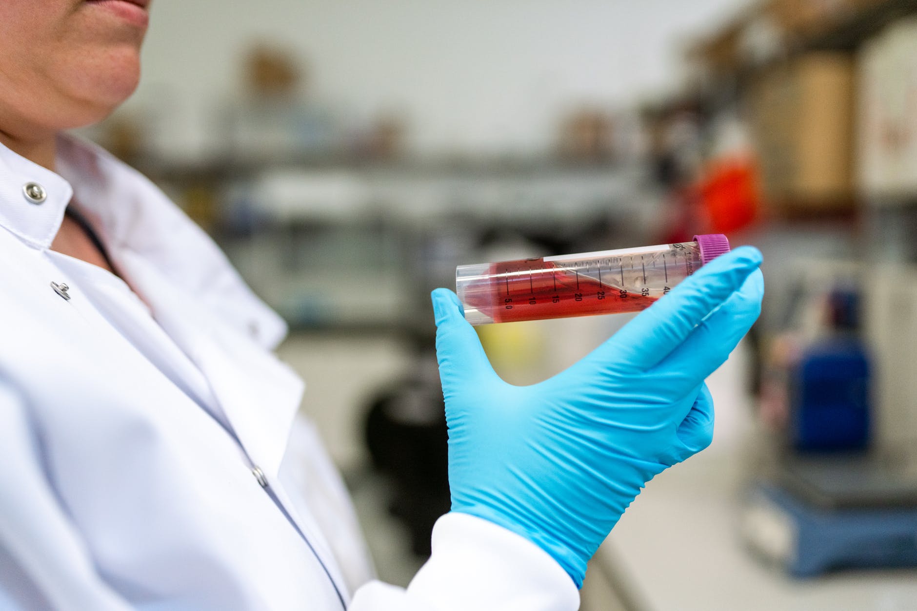 New discovery may result in a new class of diabetes drugs.