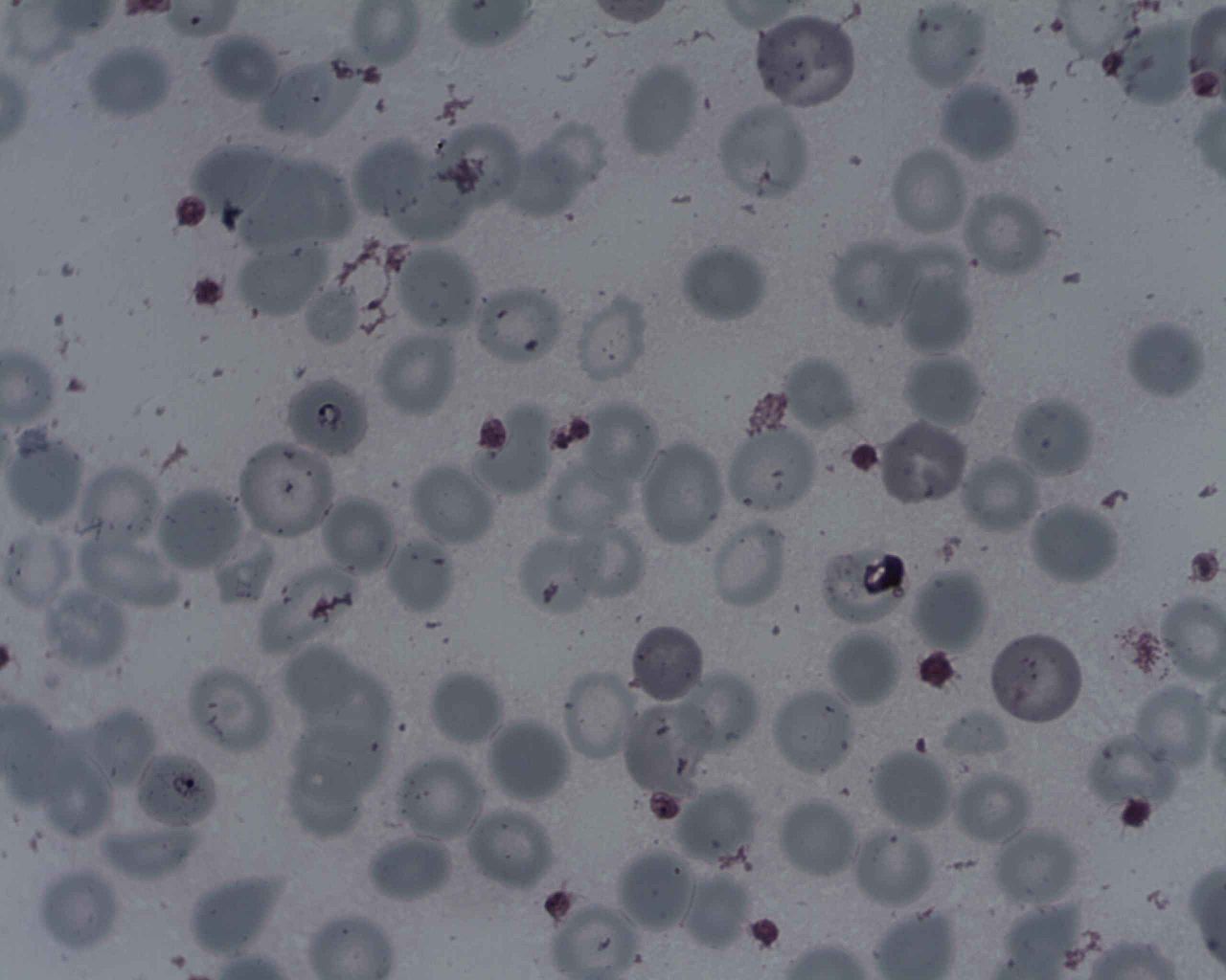 El Salvador has kicked malaria out of the country.