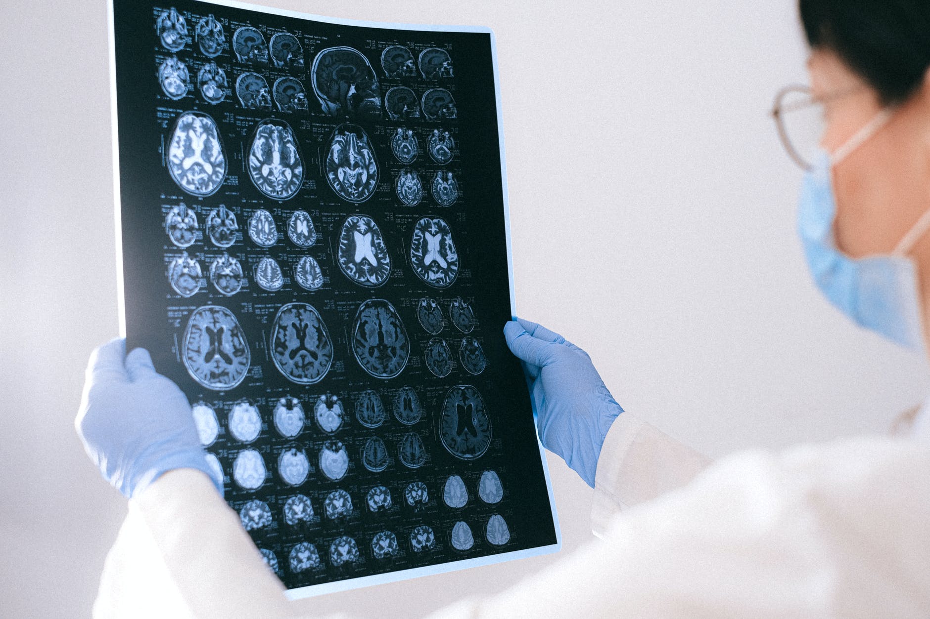 Direct electric brain stimulation shows promise against epilepsy.
