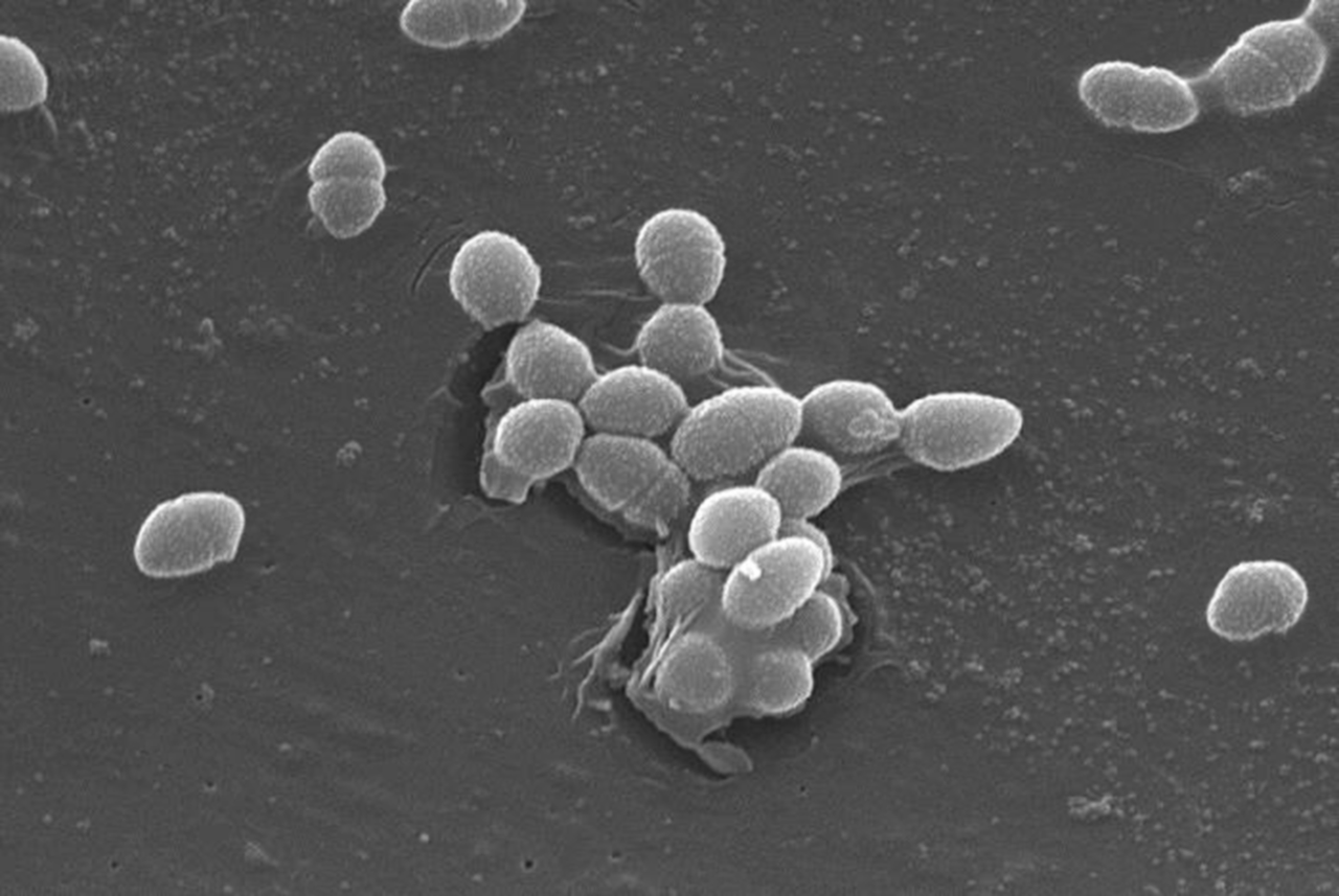 The evolutionary story of an antibiotic resistant killer.