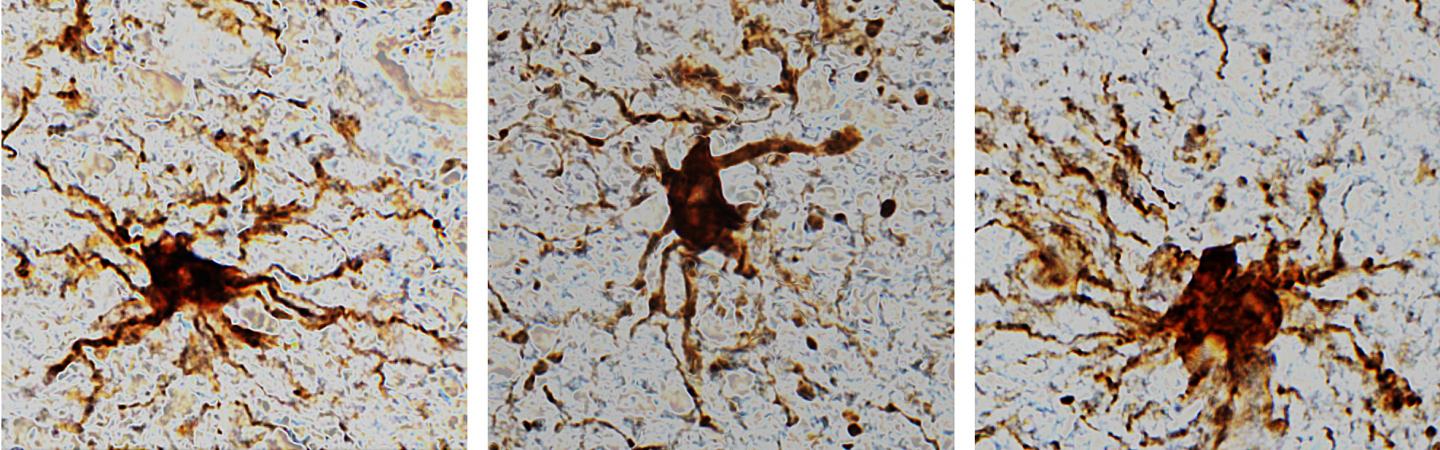 Some cells in the brain increase activity after we die.