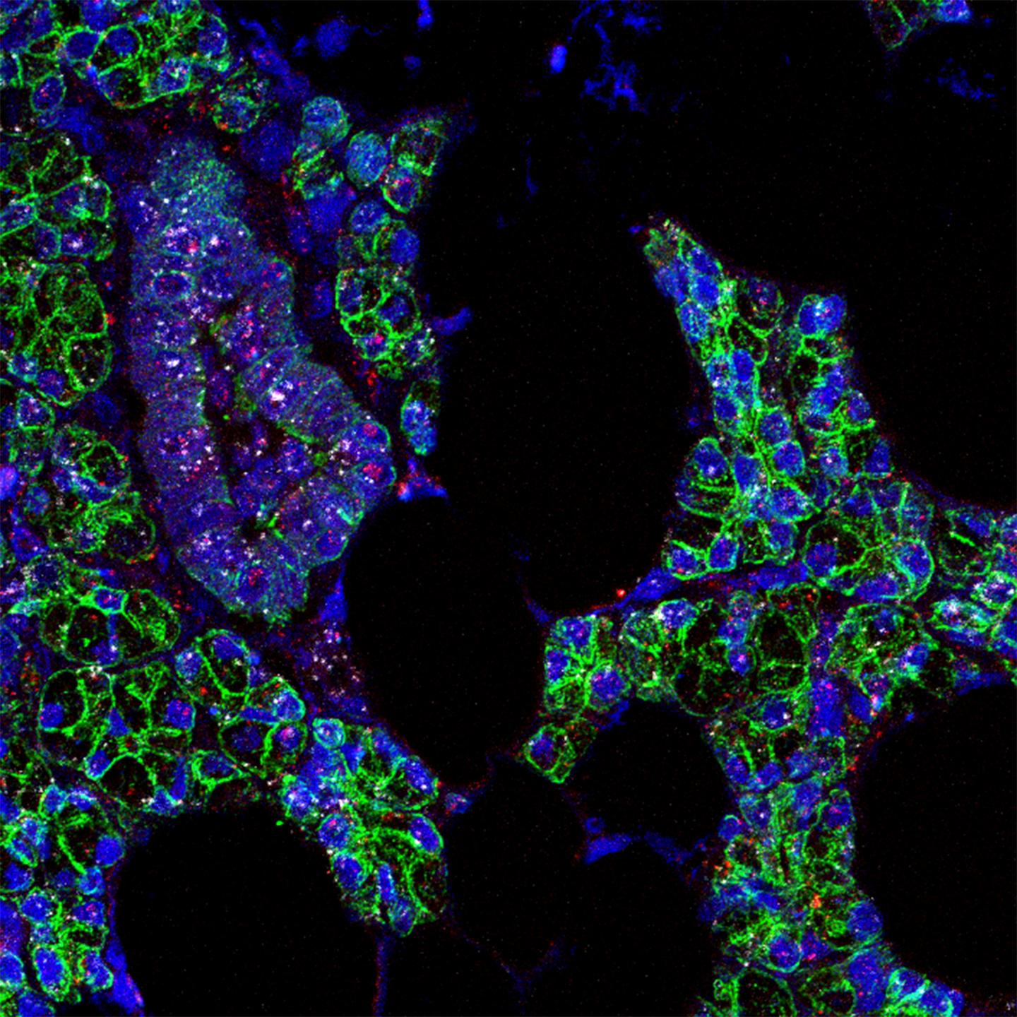 COVID-19 virus can infect mouth cells, study.