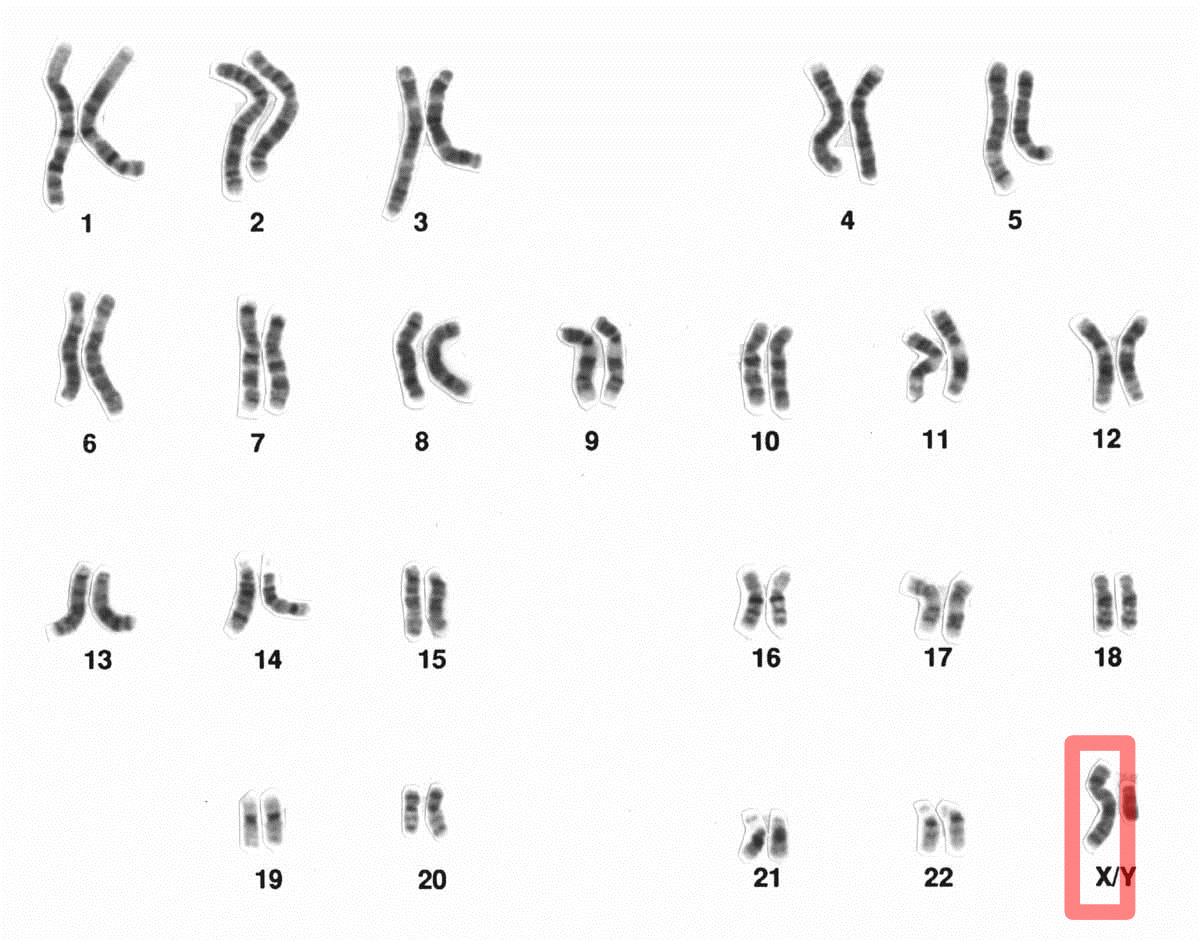Researchers Improve understanding of mysterious X chromosome.
