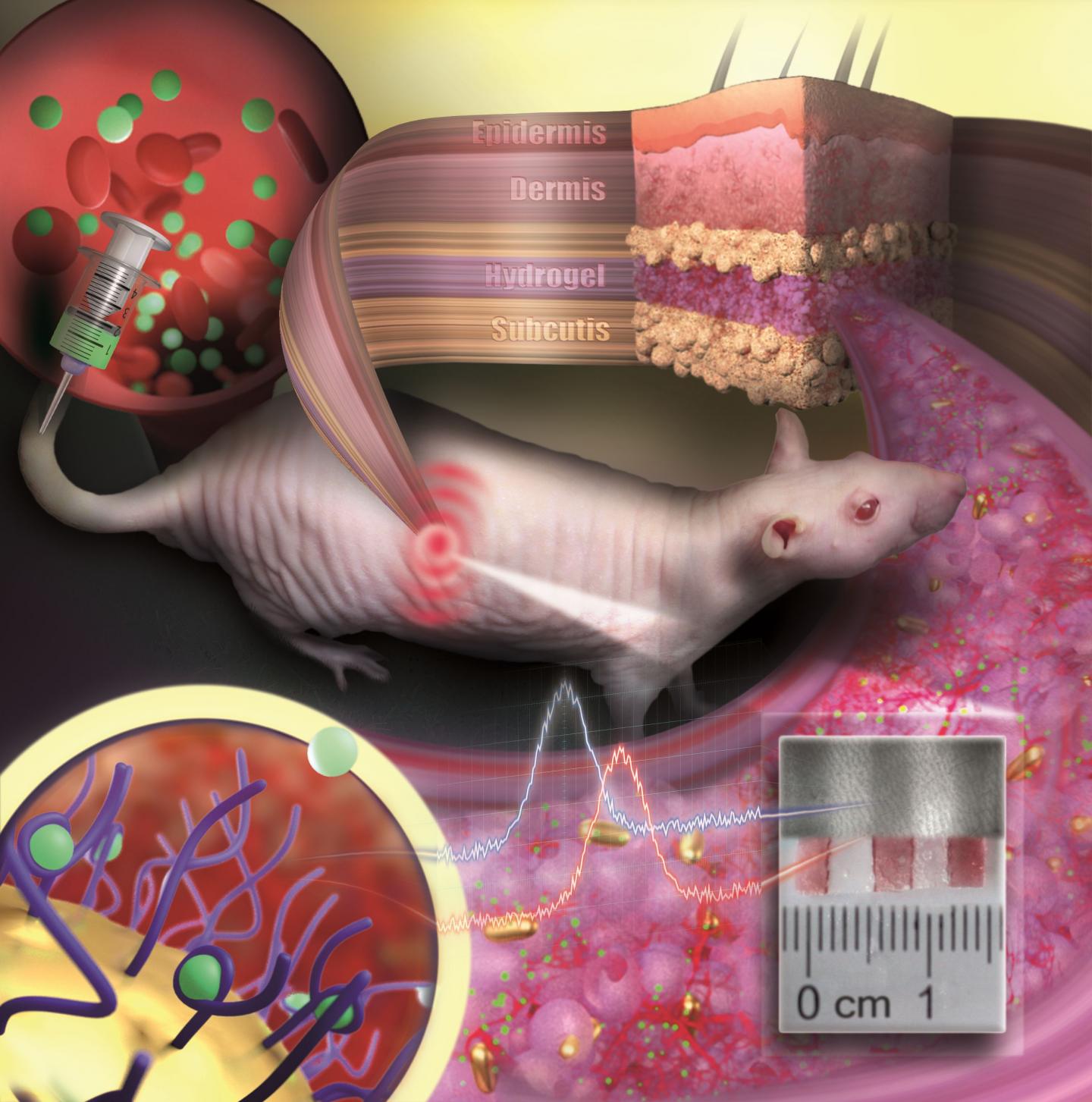 Nanogold implants can monitor drug concentrations in the body.