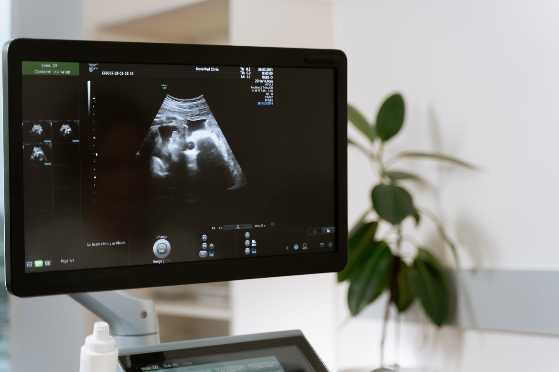 Certain birth defects can be cured by moving the embryo, study.