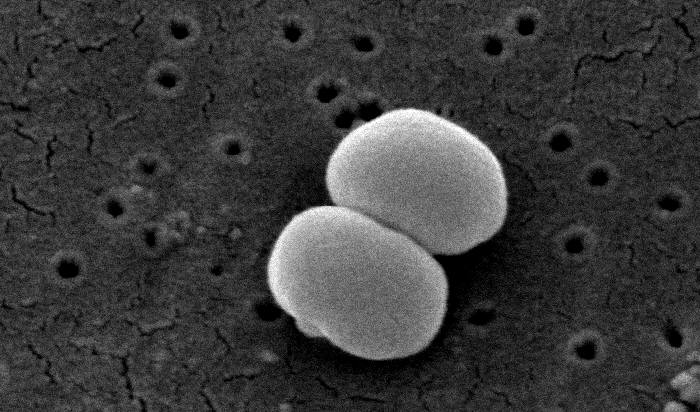 Gene cluster may turn a benign bacterium into a killer.