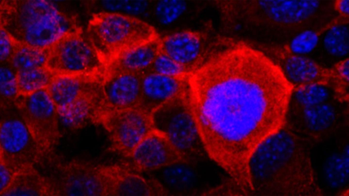 Researchers zero in on resistant pancreatic cancer cells.